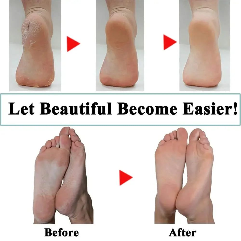 Foot Care Tool Heads Pedi Hard Skin Remover Refills Replacement Rollers for Scholls File Feet Care Tool